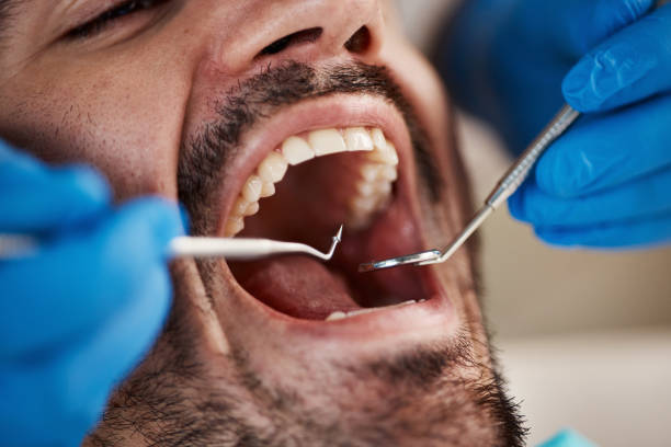 Best Pediatric Emergency Dentist in Burkesville, KY